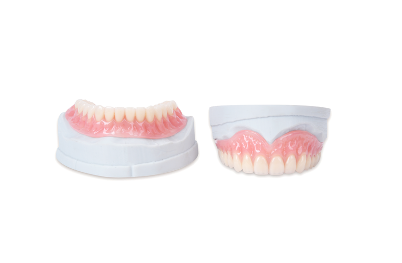 Interim or Transitional Denture